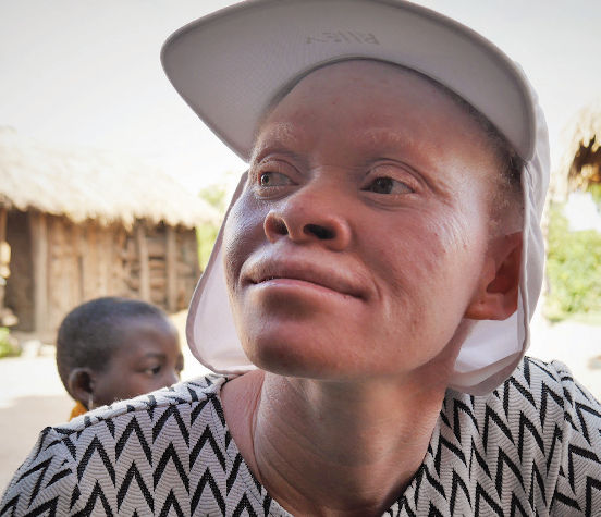 Wyposażenie domu dla albinosów w Mwanza (Tanzania)