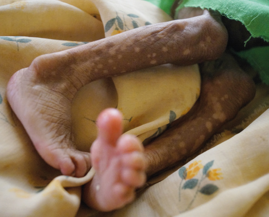 Dożywianie zagłodzonych w Mampikony (Madagaskar)