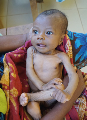 Dożywianie zagłodzonych w Mampikony (Madagaskar)