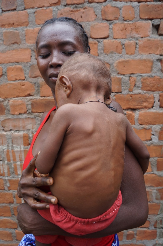 Dożywianie i edukacja dzieci w Mampikony (Madagaskar)