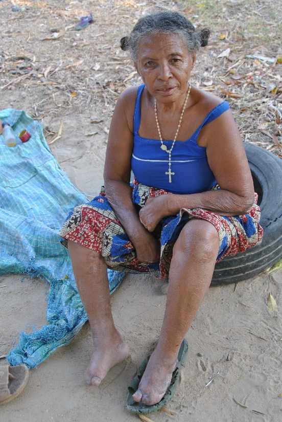 Budowa dwóch wiosek dla trędowatych (Madagaskar)